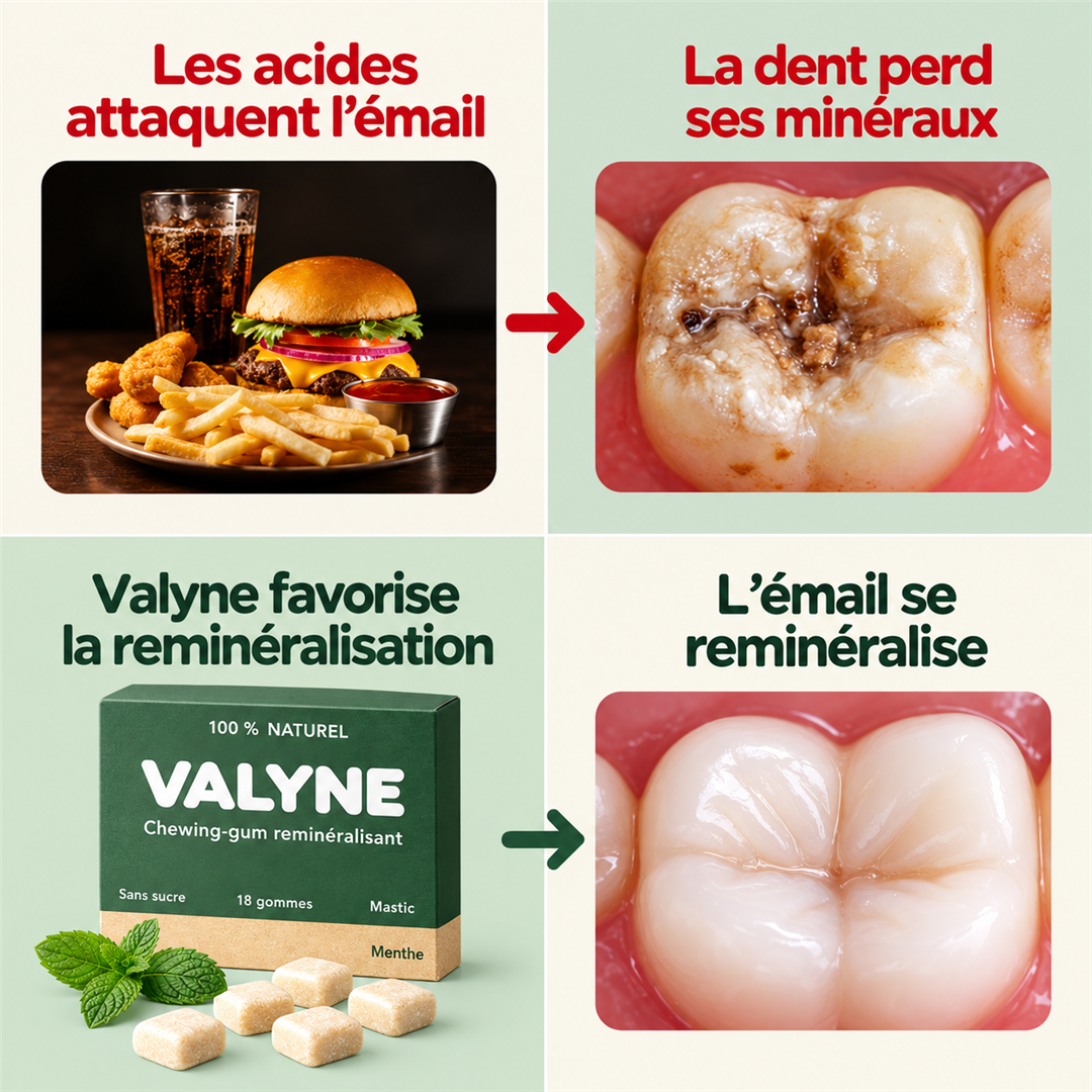 Valyne – Chewing-gum reminéralisant
