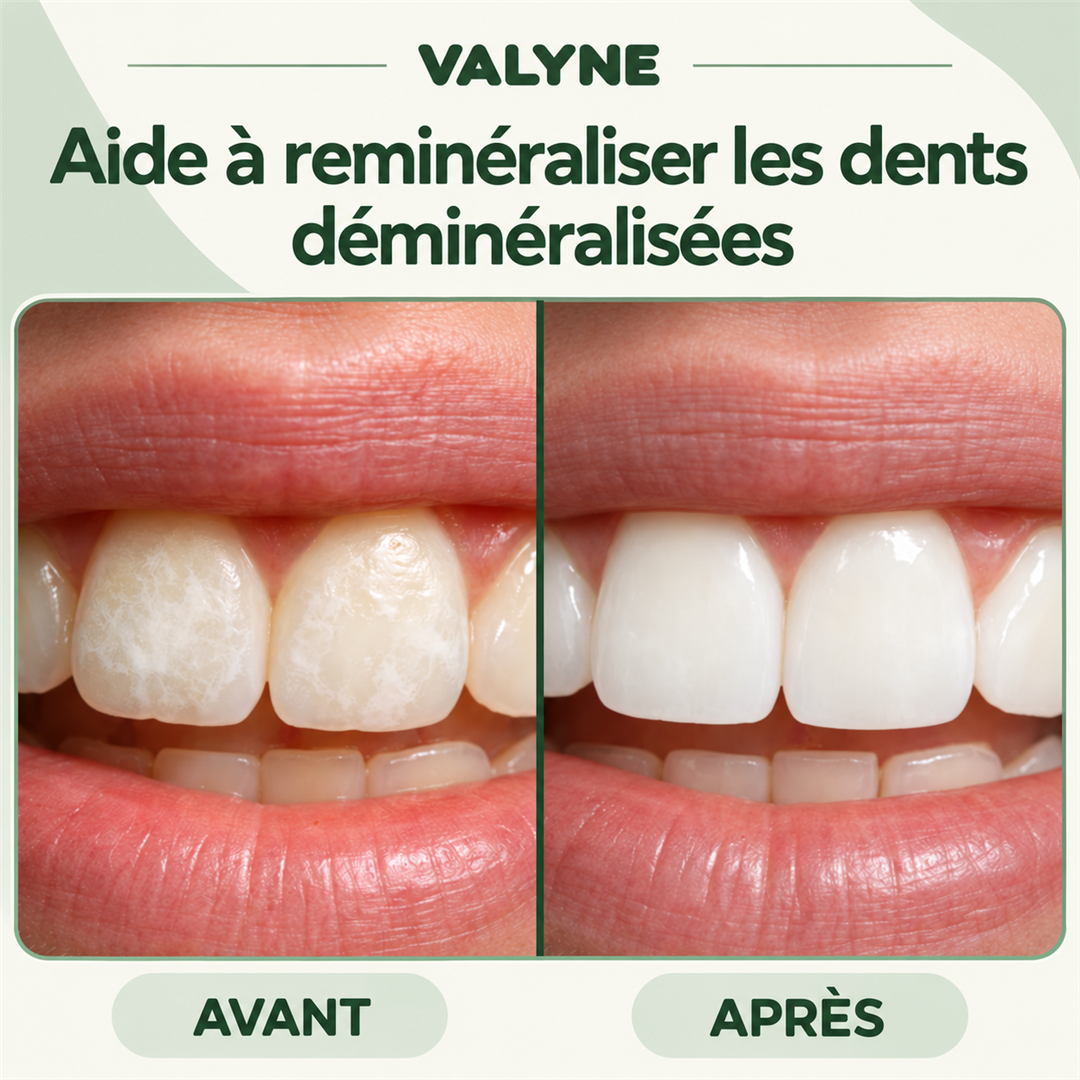 Valyne – Chewing-gum reminéralisant